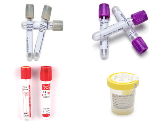 Clot/EDTA/Sugar.Urine tube